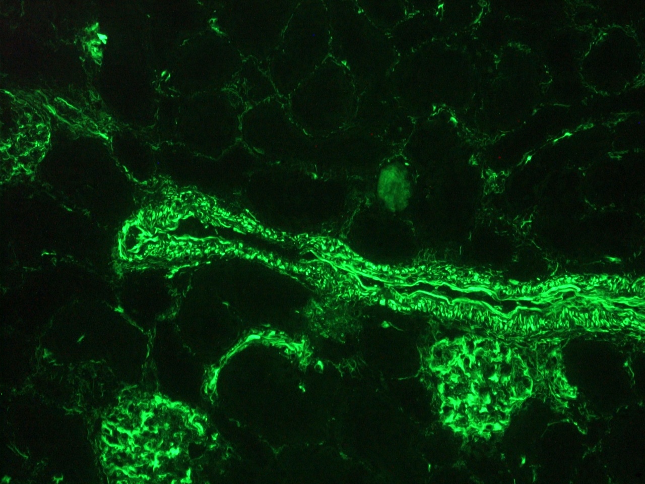 Figure 3. Immunohistochemistry with RV203 on a frozen section of human kidney showing positive staining in blood vessels, glomeruli and connective tissue cells and no reactivity in epithelial cells.